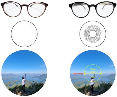 Decoding visual fatigue in a visual search task selectively manipulated via myopia-correcting lenses